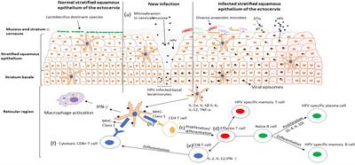 Role of Immunity and Vaginal Microbiome in Clearance and Persistence of Human Papillomavirus Infection